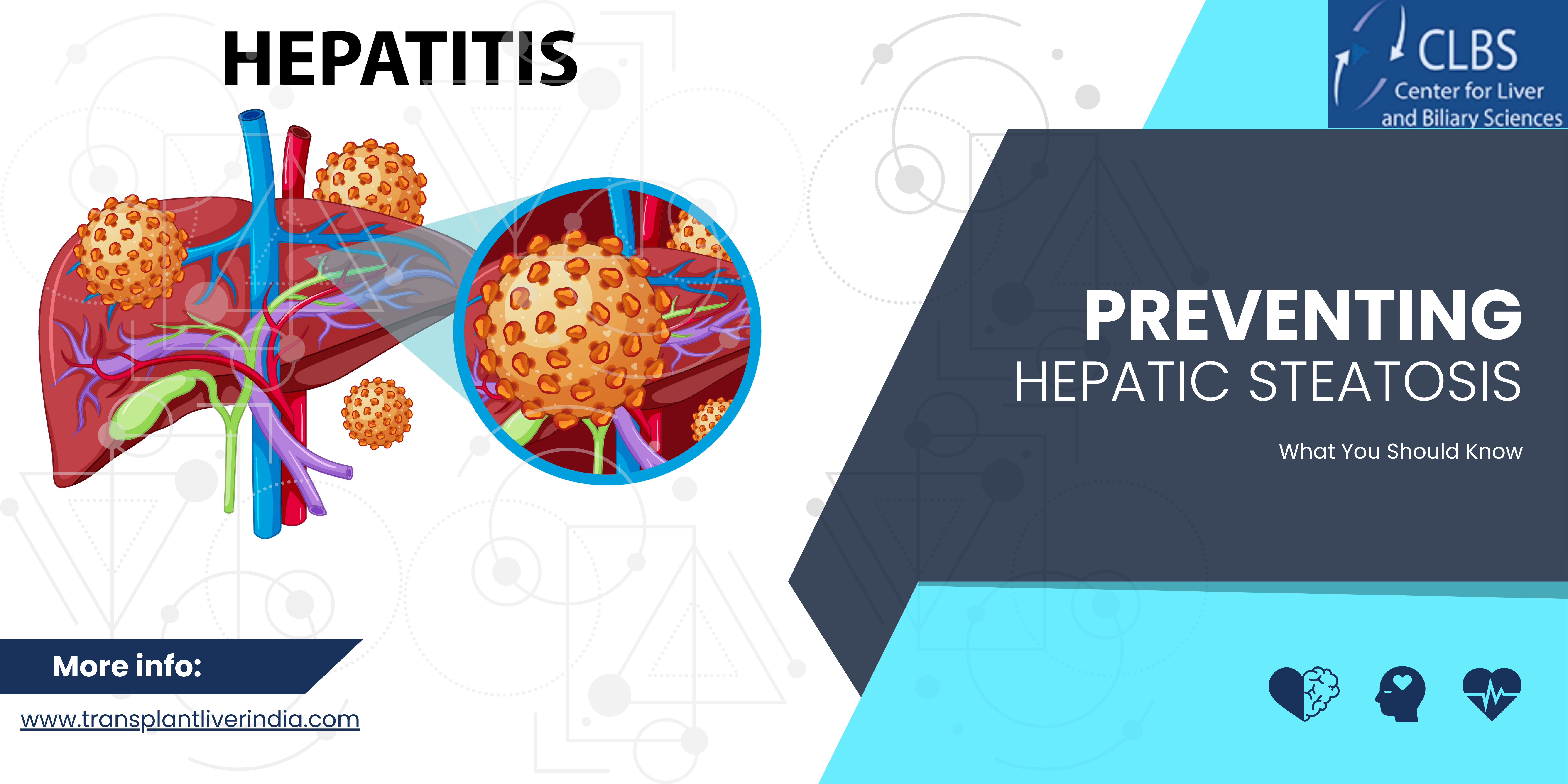 The Impact of Sleep on Hepatic Steatosis: Why Rest Matters for Liver Health