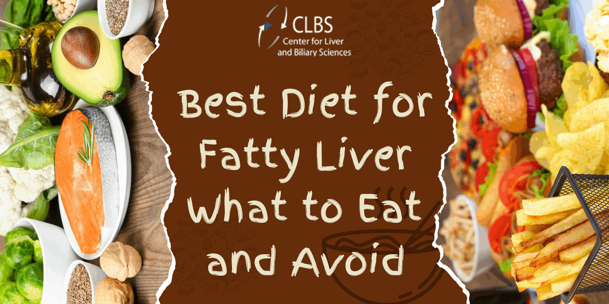 Best Diet for Fatty Liver: What to Eat and Avoid – Transplantliverindia ...