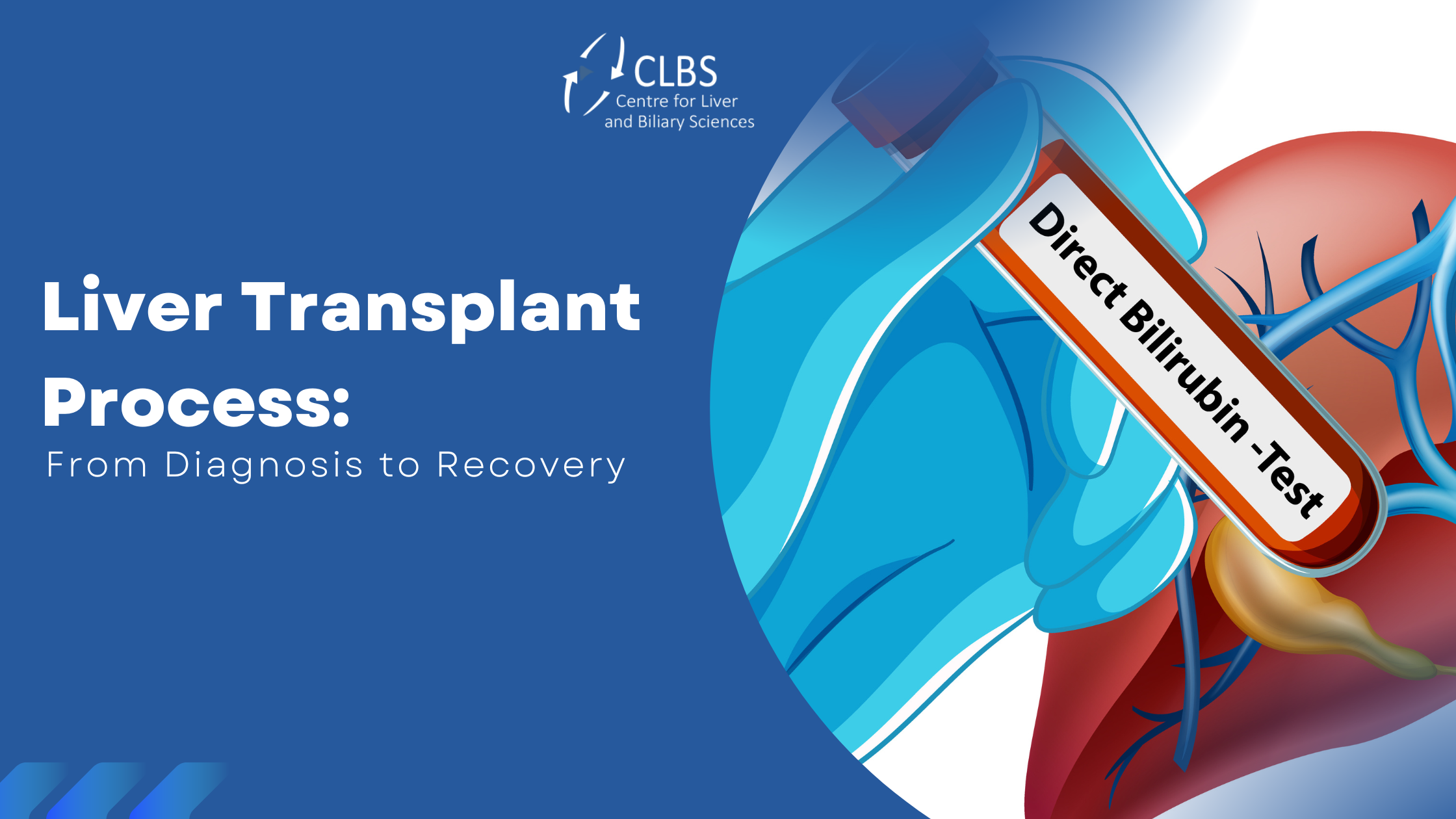 Understanding the Liver Transplant Process: From Diagnosis to Recovery