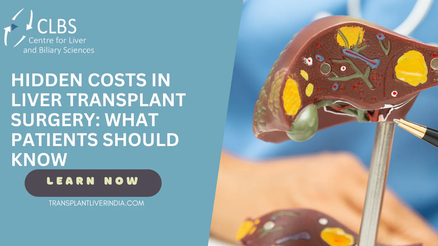 Hidden Costs in Liver Transplant Surgery: What Patients Should Know