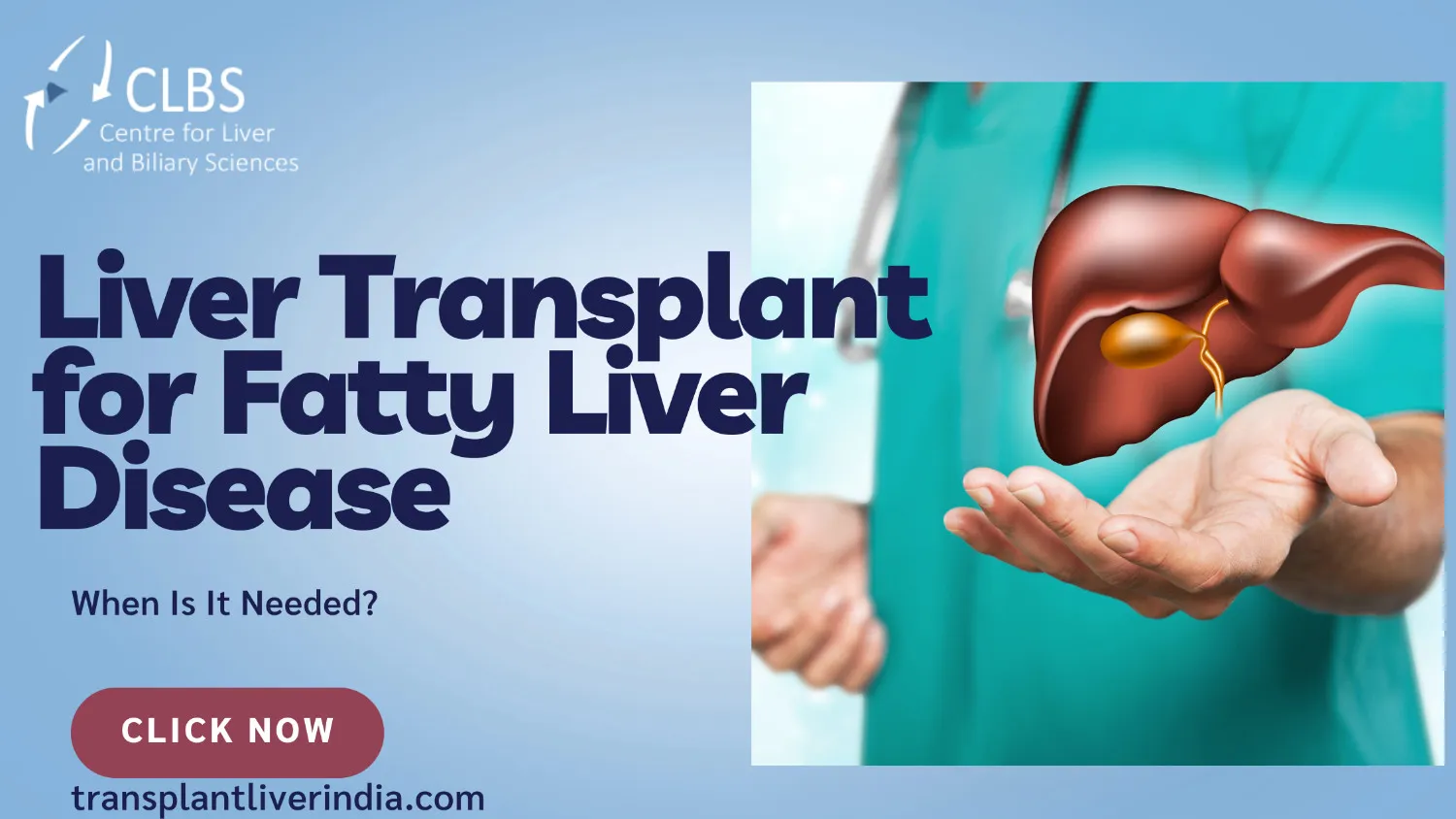 Liver Transplant for Fatty Liver Disease: When Is It Needed? 